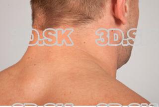 Neck texture of Gene 0001